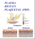 plasma rico en plaquetas (PRP)